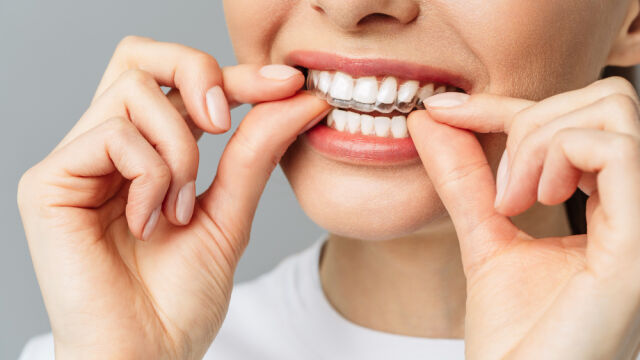 Kiedy i dlaczego warto wykonywać kontrolę jamy ustnej?